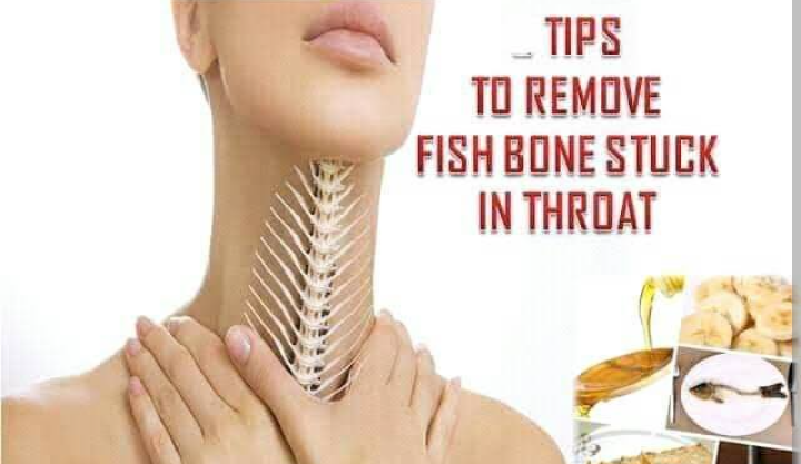 Steps To Take in Case Of A Fish Bone In Your Throat – TheNGblog