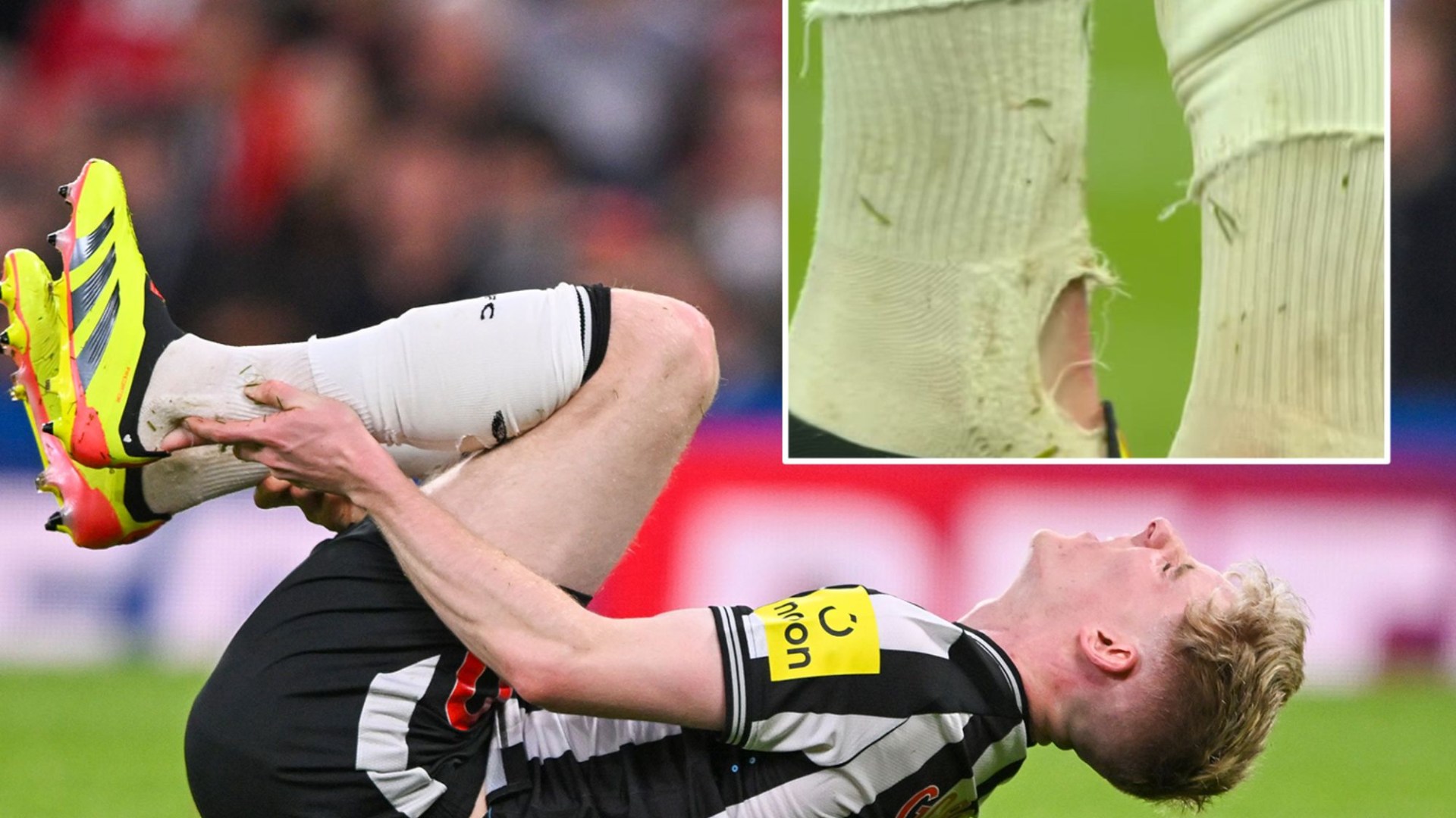 ‘Prime example to get rid of VAR’ moan Newcastle fans as Anthony Gordon shows off gruesome scar after failing to win pen