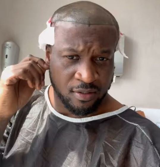 Superstar Peter Okoye Undergoes Hair Transplant, Gives Reason (Video) – TheNGblog