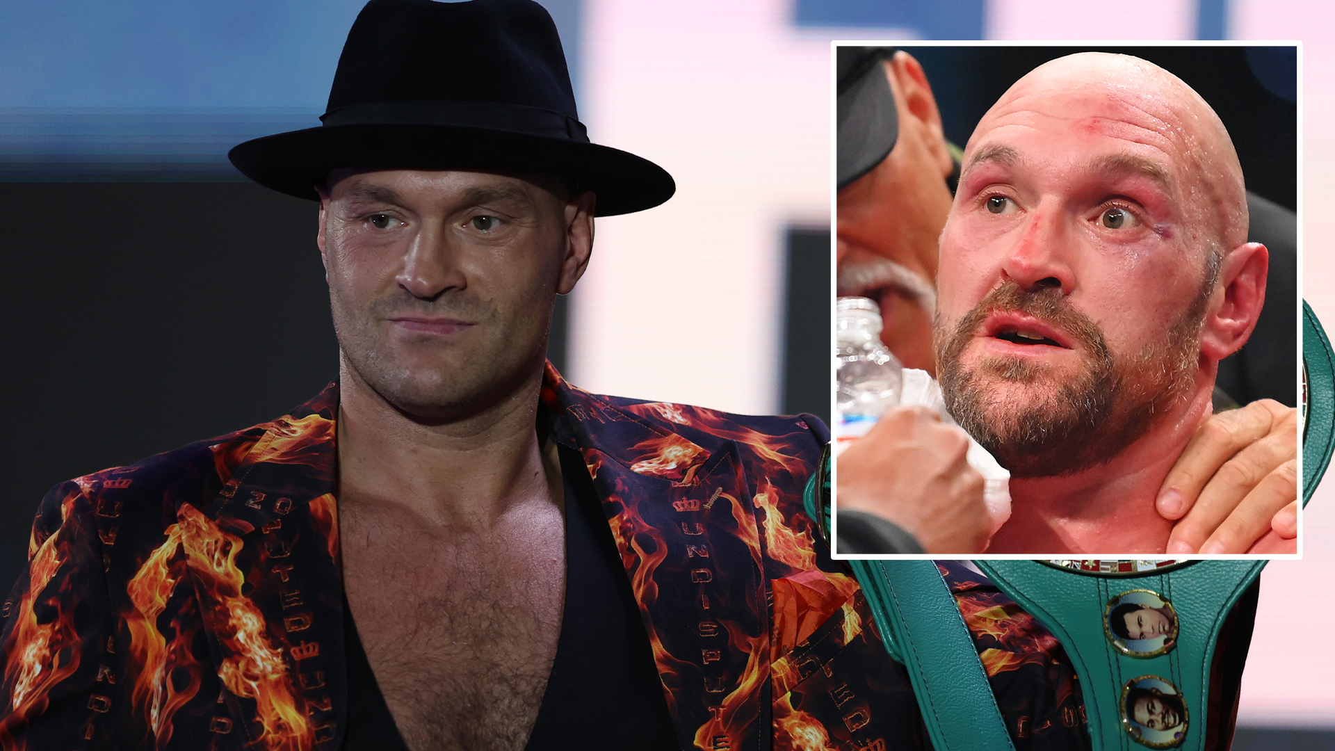 Tyson Fury ‘won’t mind if there’s blood and guts all over the ring’ as he shrugs off cuts worry ahead of Usyk fight