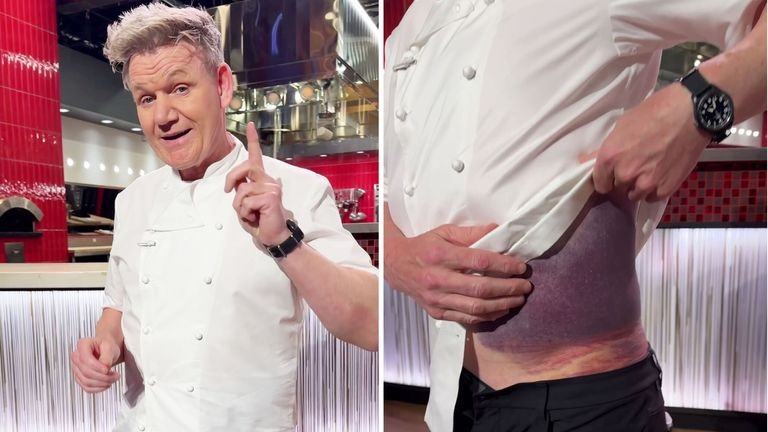 Gordon Ramsay “Lucky” to be Alive After Bad Bicycle Accident