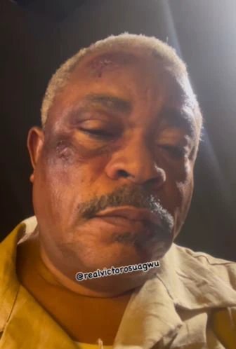 Reactions As Popular Actor, Victor Osuagwu Shares Video Showing His Bruised Face – TheNGblog