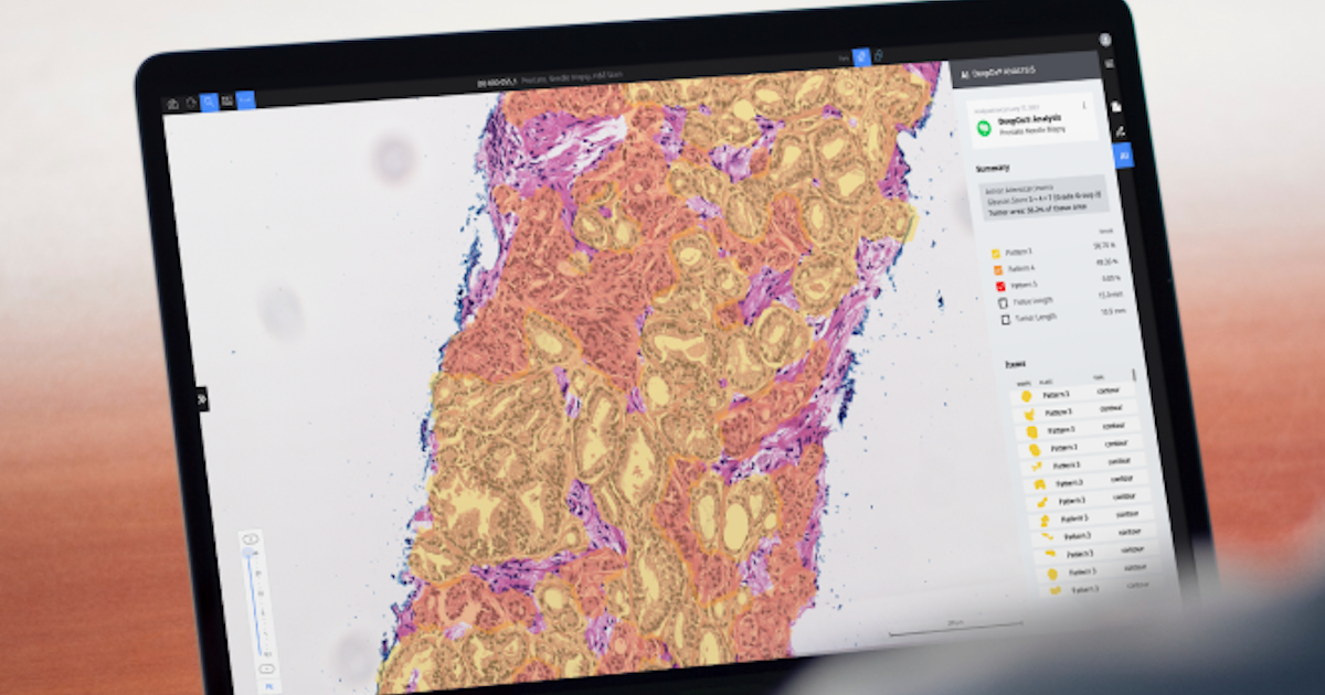 Roche boosts digital pathology with AI and more briefs